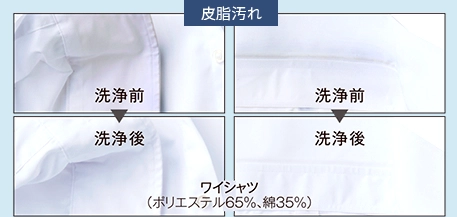 皮脂汚れ